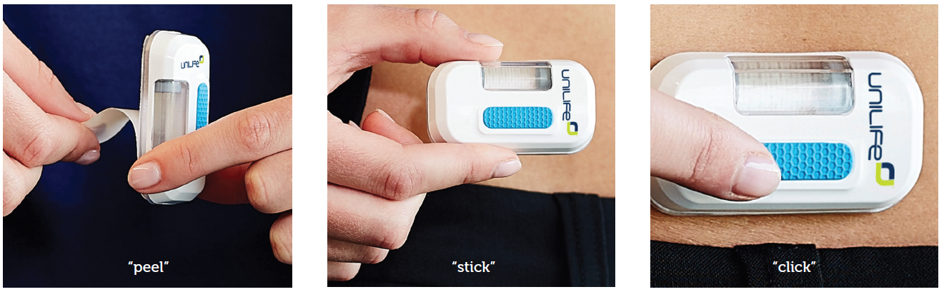 Selecting The Right Wearable Injector Technology And Partner 