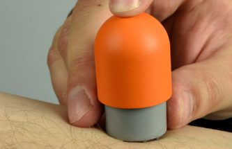 TERIPARATIDE MICRO-PATCH™: A SOLID MICRONEEDLE PRODUCT NEARING CLINICAL TRIALS