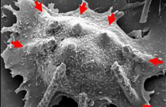 SKIN-MOUNTABLE FLEXIBLE NEEDLE PATCH FOR MINIMALLY INVASIVE CONTROLLED DRUG DELIVERY