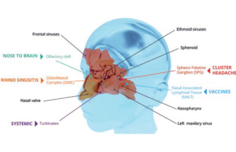 INTEGRATED TURNKEY SOLUTIONS: KEY TO SUCCESSFUL NASAL COMBINATION PRODUCT DEVELOPMENT