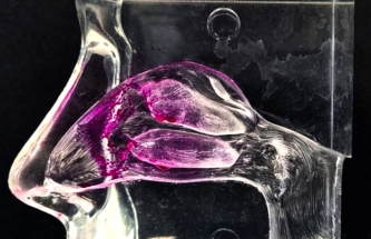 FORMULATION OPTIONS IN NASAL DRUG DELIVERY