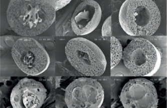 GASTRIC FLOATING MICROCAPSULES FOR THE MANAGEMENT OF PARKINSON’S DISEASE
