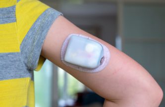 COMPLEXITY OF PATCH PUMP ASSEMBLY AND CONSIDERATIONS FOR MASTERING IT