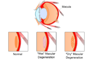 SUSTAINED, CONTROLLED DRUG DELIVERY TO THE EYE