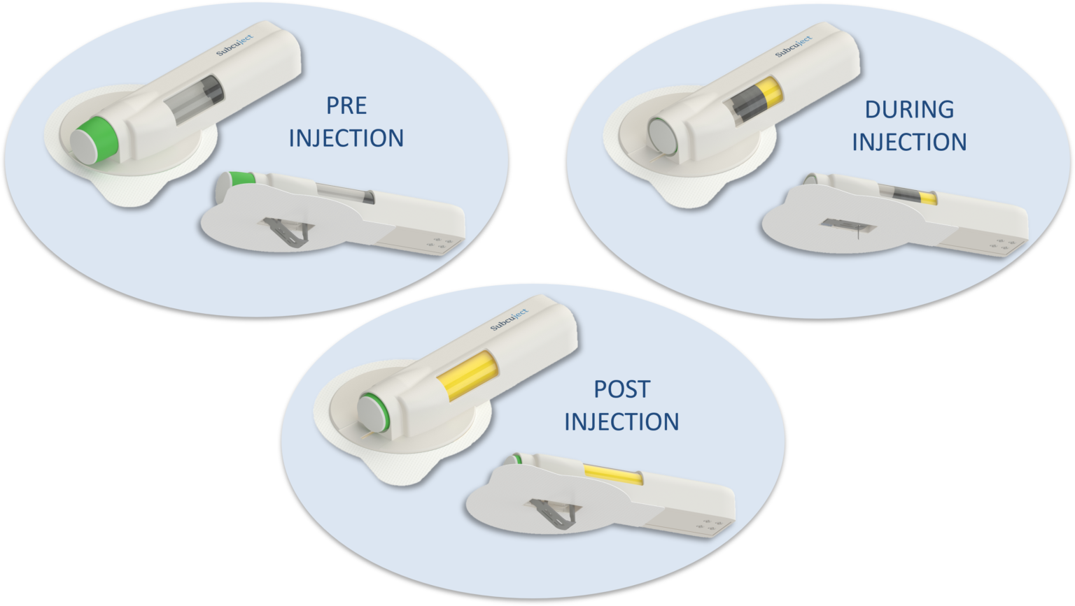 Low Complexity Easy To Use Wearable Injection Platform Ondrugdelivery