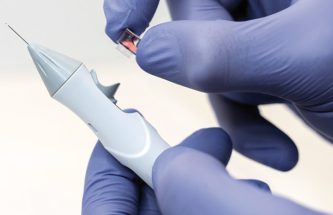 ACQUIRING A LIQUID BIOPSY INCIDENTAL TO INTRAVITREAL INJECTION