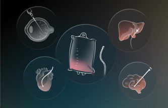 DRUG DELIVERY DEVICE INNOVATION IN CELL AND GENE THERAPIES